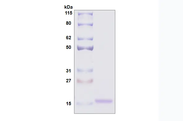 [MC06-050] Recombinant Human Galectin 10, His Tag -50 ug